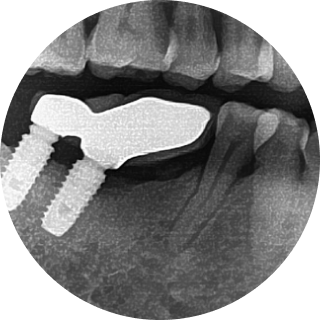 이로운치과의 문제 예방
